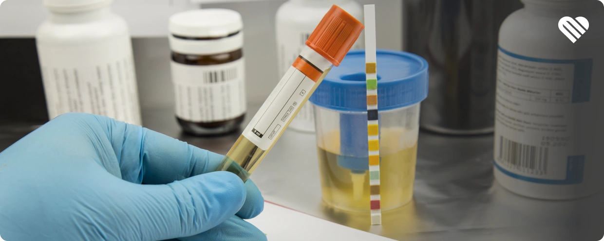 Does Passing a Home Test Mean You'll Pass a Lab Test?