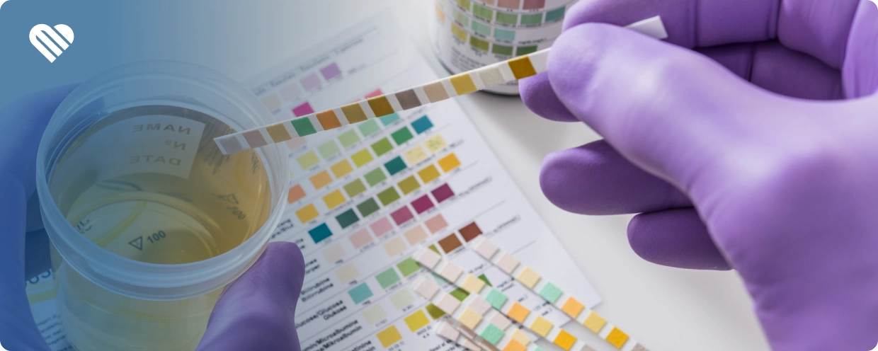 Can You Fail a Drug Test From a Contact High?