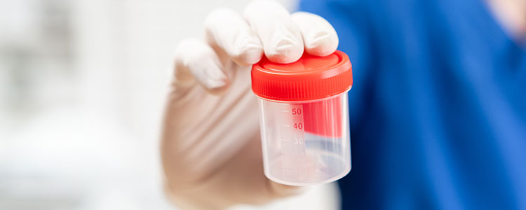 urine drug test